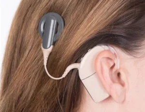 Advanced Bionics have issued a voluntary recall of an initial version of their HiRes Ultra and Ultra 3D cochlear implant due to reported decreased performance of the device.